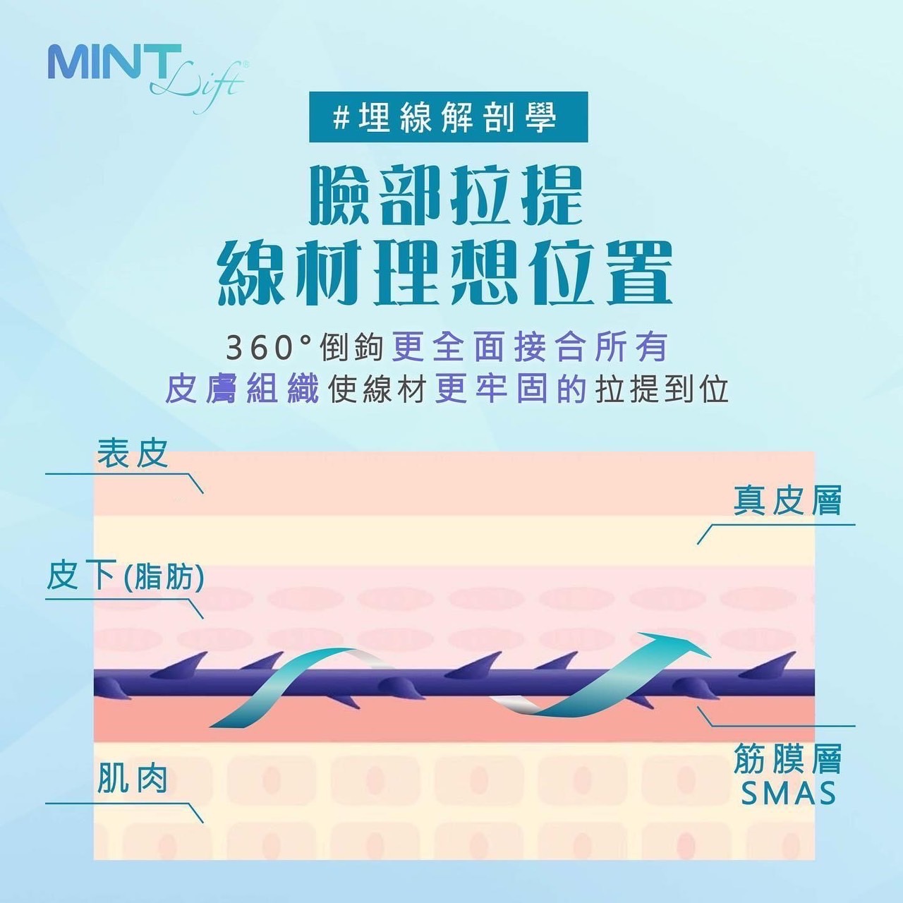 神力拉提, MINT, 秘特拉提線 神力拉提, MINT, 秘特拉提線