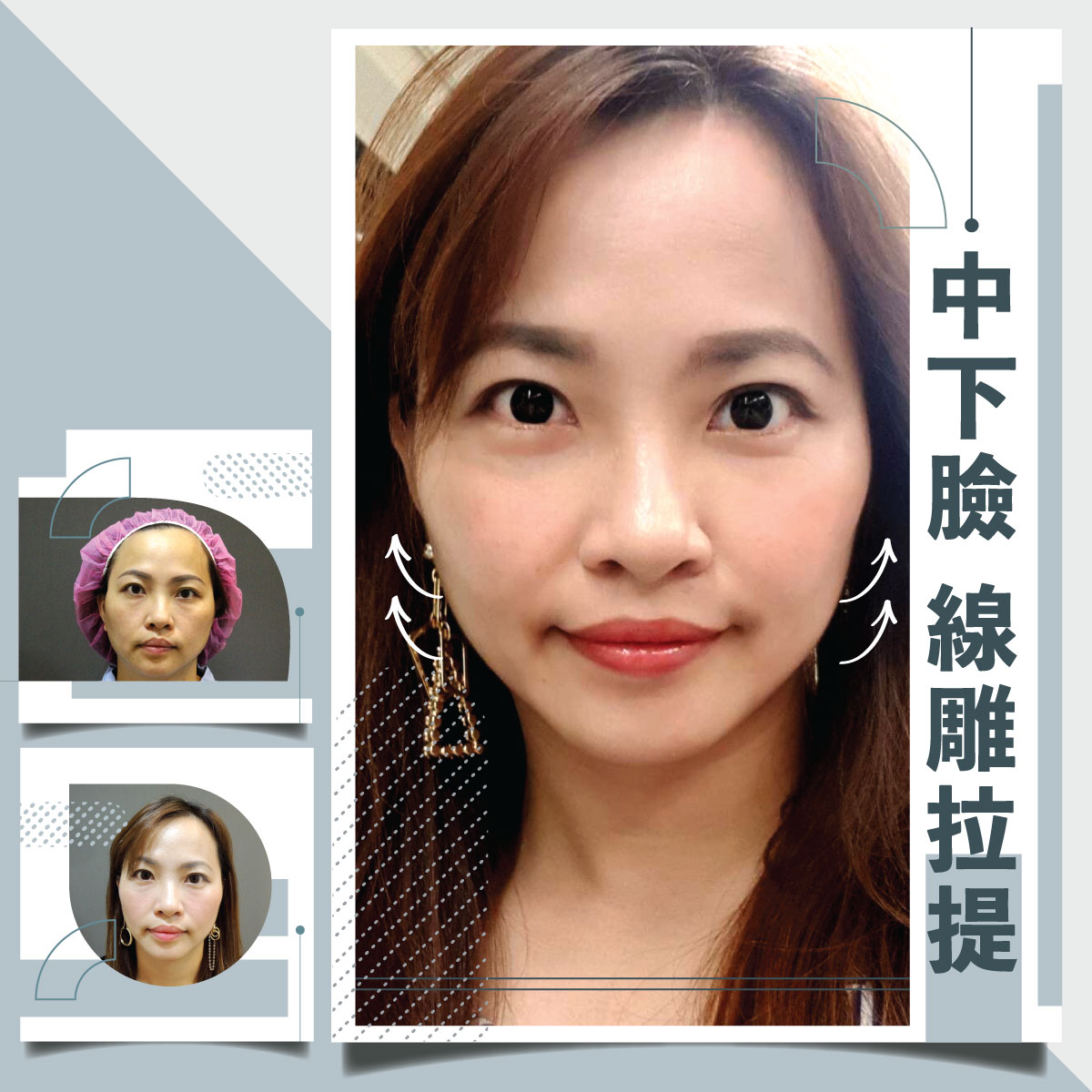 雙螺旋線雕拉提
