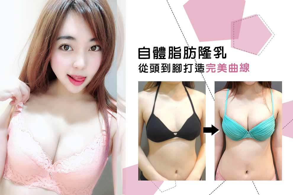 隆乳哺乳,隆乳案例
