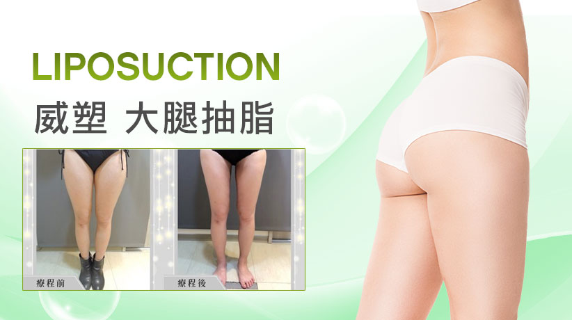 大腿抽脂