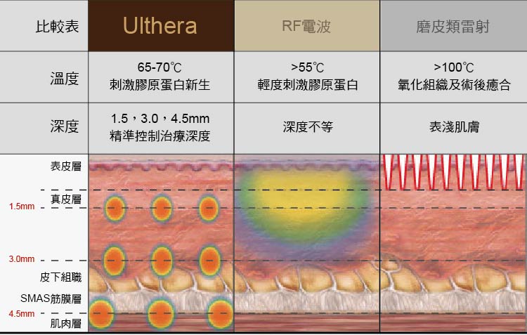 音波拉皮比較 音波拉皮比較